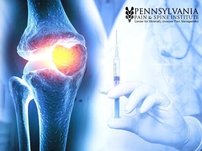 Pain relief integrative approaches lower back alternative category treatments untitled design